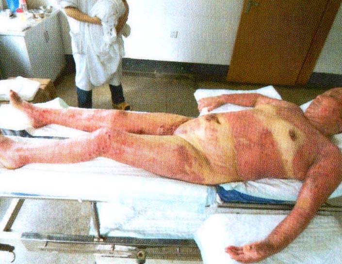 臨床資料